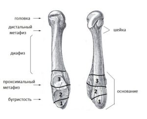 Головки плюсневых костей