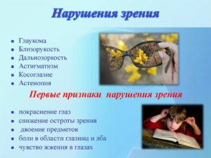 Симптомы болезни - нарушения зрения у ребенка