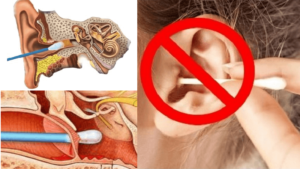 После гриппа правое ухо остро реагирует на звуки и громкую речь.