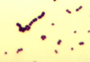 Enterococcus faecalis 10 в 5 ст. КОЕ/мл.