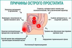 Спазмы в простате