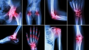 Клинические и патобиомеханические проявления патологии позвоночника и суставов конечностей