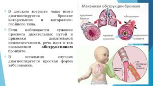 Субфебрильная температура у 11 месячного ребенка после пневмонии и обструкции.