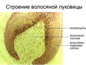 Как уничтожить волосяную луковицу