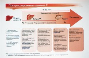 Гепатит С: профилактика, симптоматика, диагностика