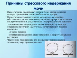 ЛФК в терапии недержания мочи при напряжении