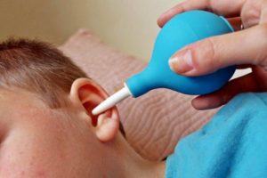 как правильно промыть ухо