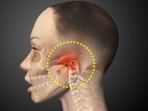 Симптомы болезни - боли в челюсти