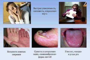 Каковы симптомы анемии?