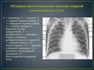 ОПИСАНИЕ РЕНТГЕНА ГРУДНОЙ КЛЕТКИ