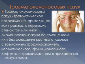 Травмы носа и околоносовых пазух