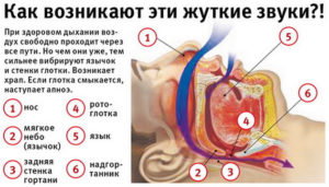 Храп: причины и последствия