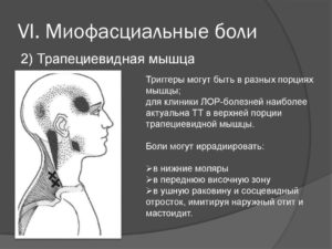 Симптомы болезни - миофасциальные боли