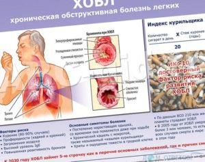 Что делать при болях за грудиной после гриппа и острого бронхита?