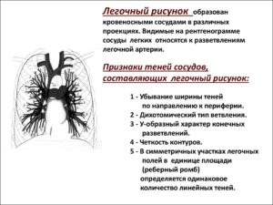 ФЛГ: Обогащён прикорневой лёгочный рисунок