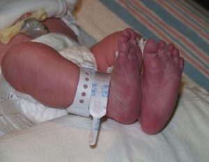 Синеют ножки у ребенка