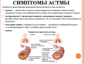 Симптомы приступа астмы