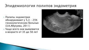 Обнаружен микрополипоз эндометрия, планирую ЭКО