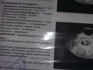 Эхографическое исследование в ранние сроки беременности