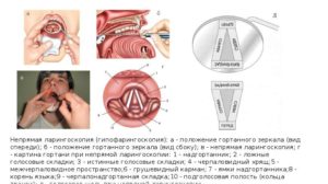 Методы исследования ЛОР-органов