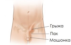 боли из правого яичка в пах и поясницу у мальчика 8-и лет