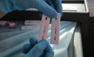 Тестирование на вирус иммунодефицита человека (ВИЧ)