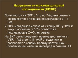 Симптомы болезни - нарушения желудочковой проводимости