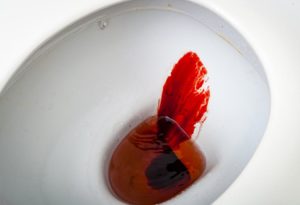 Кровь после похода в туалет