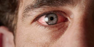 Симптомы болезни - боли в глазном яблоке