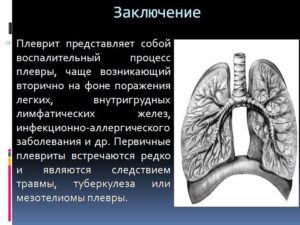 Воспалительные заболевания плевры