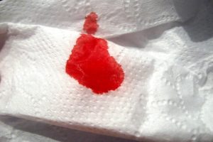 Кровяные выделения на туалетной бумаге