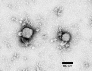 Семейство аренавирусов: Вирус лимфоцитарного хориоменингита (ЛХМ)