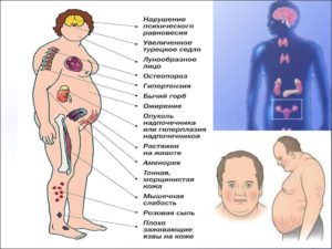 Симптомы болезни - нарушения гормонального баланса