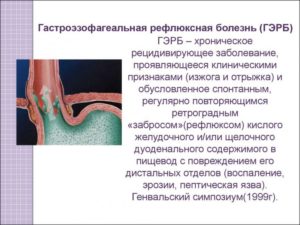 Изжога и гастроэзофагеальная рефлюксная болезнь (ГЭРБ)