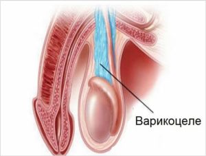 На мошонке стали просматриваться вены. Может из-за стресса?