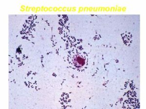 Стафилококк золотистый, стрептококк и клебсиелла пневмония
