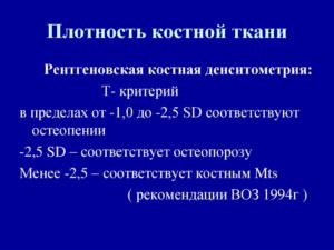 Минеральная плотность костной ткани