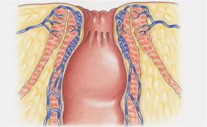 Аноректальная боль