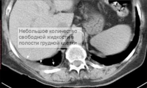 расшифровка описания снимка