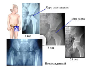 ядра окостенения