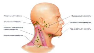 воспаление лимфоузлов на голове