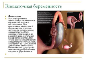 можно ли беременеть через 2 месяца после внематочной?