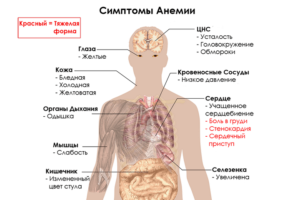 Каковы симптомы анемии?