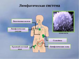 Заболевания лимфатической системы