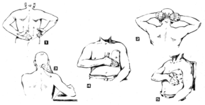 Общий массаж при туберкулезе(с обьяснением противопоказаний)