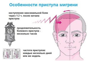 Приступы мигрени появляются каждый день?