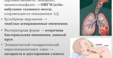 Часто задаваемые вопросы о вирусном (асептическом) менингите