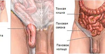 Пульсация в промежности, простате