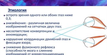 Содружественное косоглазие (Strabismus concomitans, Heterotropia)