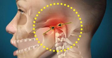 Симптомы болезни - боли в челюсти